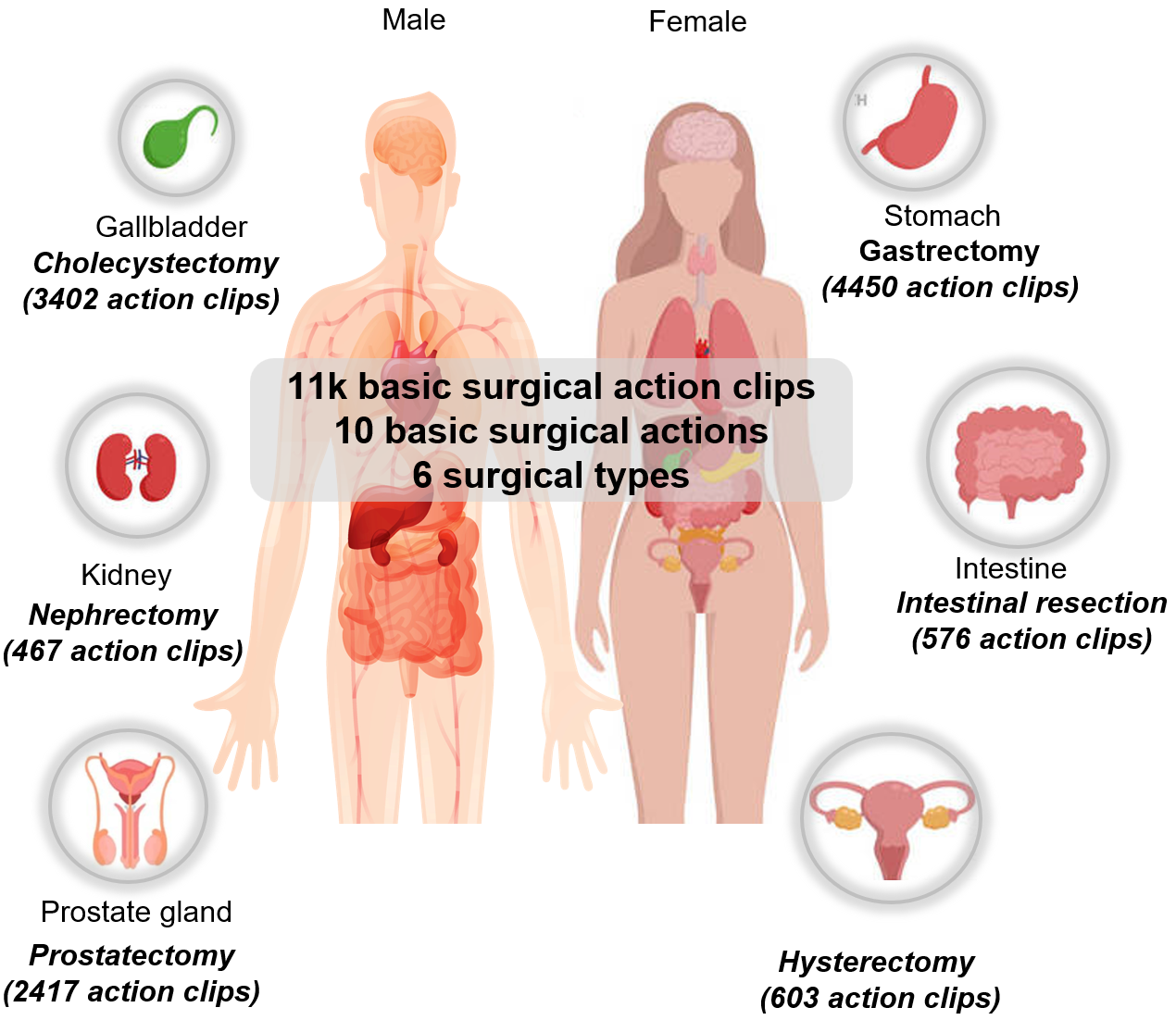 Human body surgical region overview